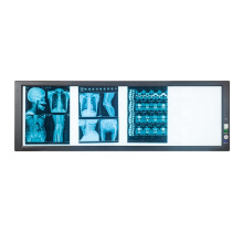 Chinese factory Quadruple LED X-ray film viwer box thin LED x-ray film scanner in Hospital